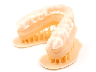 Модель из материала Dental Peach с установленным сплинтом из Dental Clear